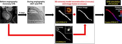 Computational Fractional Flow Reserve From Coronary Computed Tomography Angiography—Optical Coherence Tomography Fusion Images in Assessing Functionally Significant Coronary Stenosis